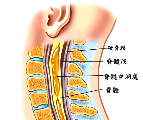 北京太壹园中医——脊髓空洞其分为4型，你属于那一型？？