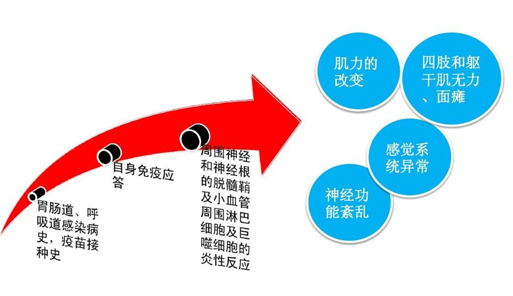 御方生髓汤xx格林巴利综合症分析