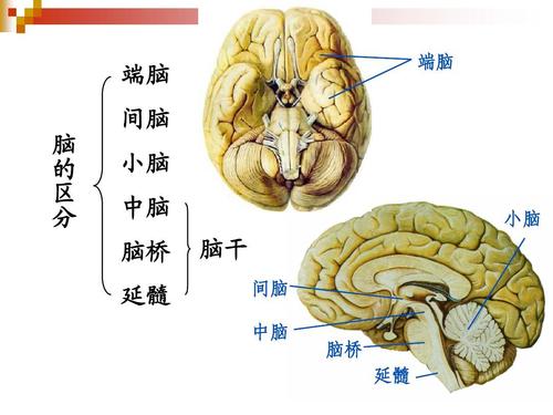脫髓鞘：腦橋中央髓鞘溶解癥
